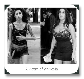 Anorexia Cure: Image of Anorexic woman