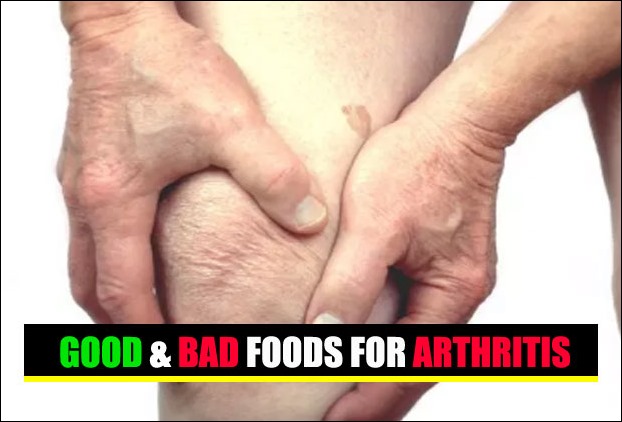 What to eat and not to eat in arthritis !