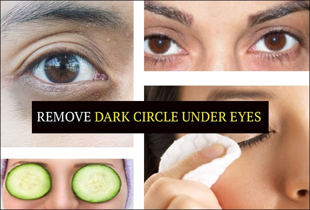 Get rid of dark circles under eyes - 10 powerful home remedies