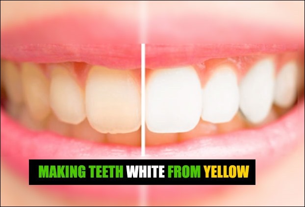 Several methods are available to make your teeth white naturally from yellow. 