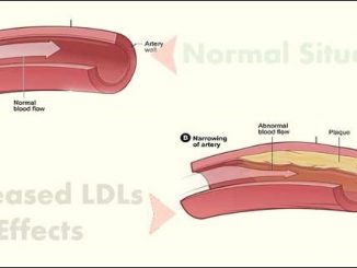 An increased risk of heart disease and atherosclerosis prevails in case of increased LDL