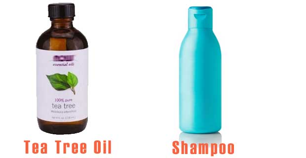 Tea tree oil works well in combating dandruff