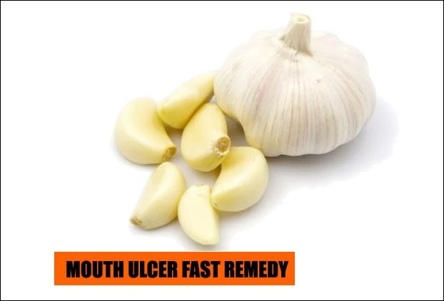 You can cure mouth ulcer fast with garlic buds remedy