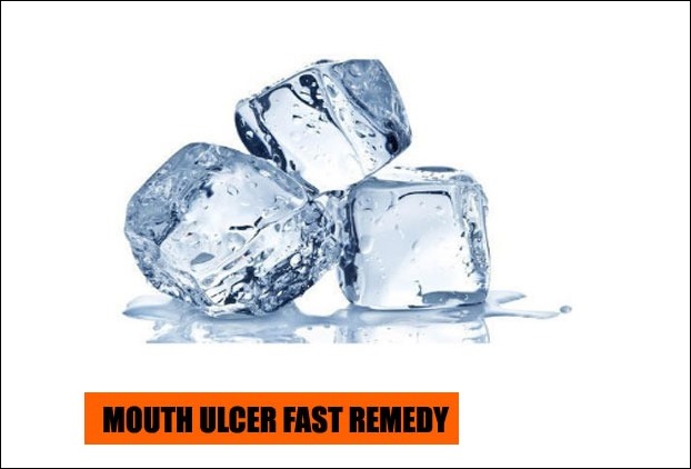 Application of ice cubes can help to suppress burning sensation of mouth ulcers
