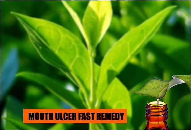 Tea-tree oil’s has fast pain relieving and healing properties in mouth ulcer