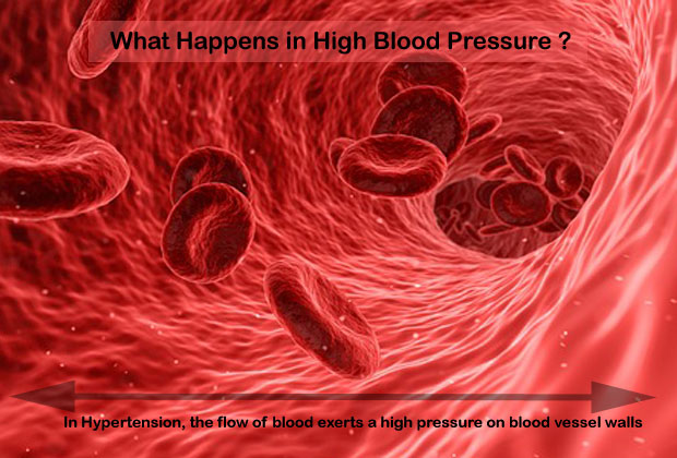 In High Blood Pressure, the flow of blood exerts an increased pressure on blood vessel walls.