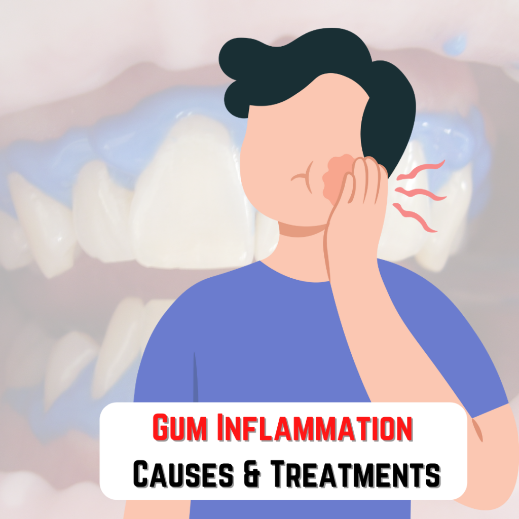 Gum Inflammation Treatment Guide