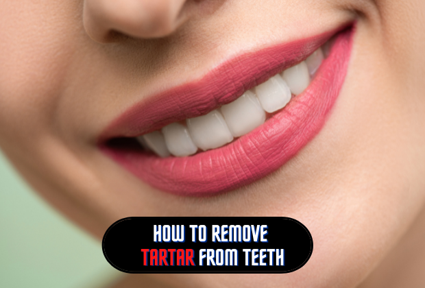 How to remove tartar from teeth