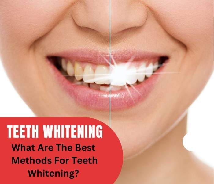 What Are The Best Methods For Teeth Whitening? 