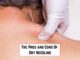 The pros and cons Of Dry Needling