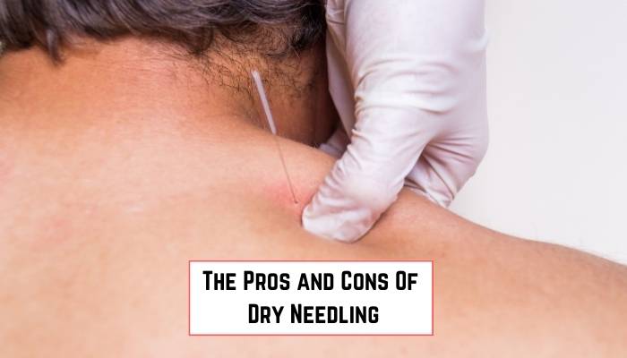 The pros and cons Of Dry Needling
