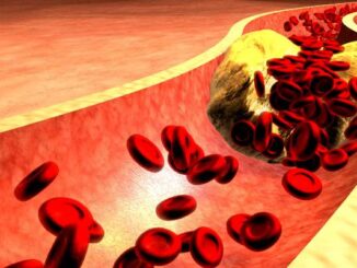 Why should you have your cholesterol levels tested?