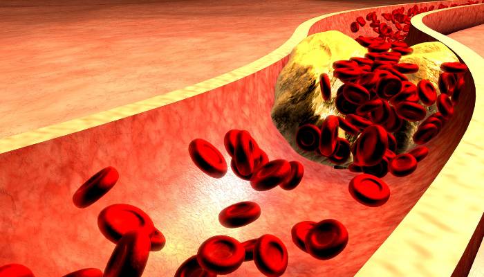 Why should you have your cholesterol levels tested?