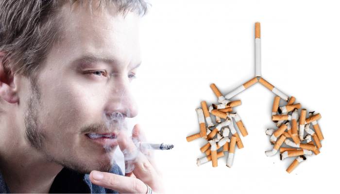 Tips to help in quitting smoking habit