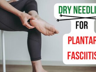 Dry needling for plantar fasciitis
