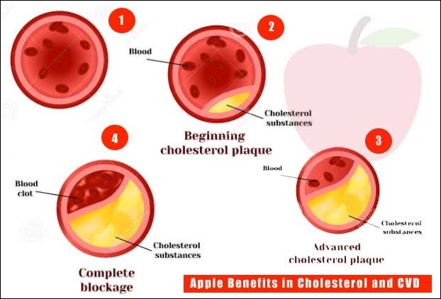 Plaque begins to deposit in the arteries when Heart diseases begin