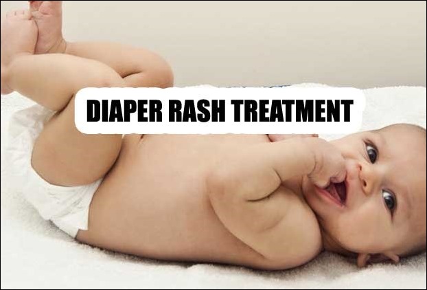 Coconut treats diaper Rashes in babies